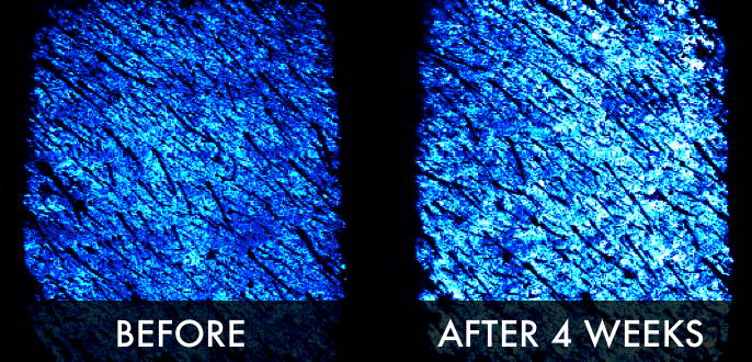 Clinical trial hydration before and after 4 weeks
